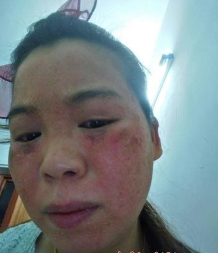 广东被判美容店变成了能力超范围(美容店祛斑医疗美容脸部面部)