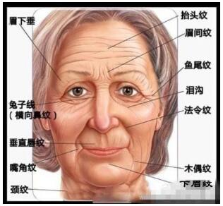 来吧帮您三步皱纹(面部皱纹额头三步光明网)