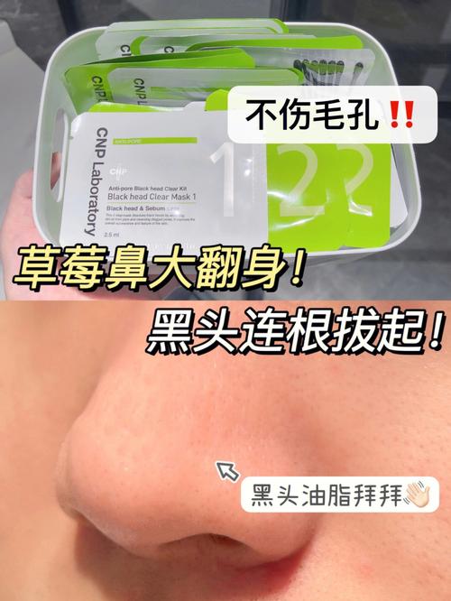 黑头烦人草莓轻松(黑头烦人草莓皮肤粉刺)