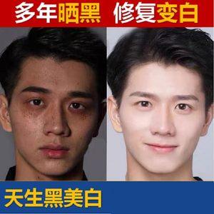 黑色素脸上男人(黑色素超能脸上防晒肌肤)