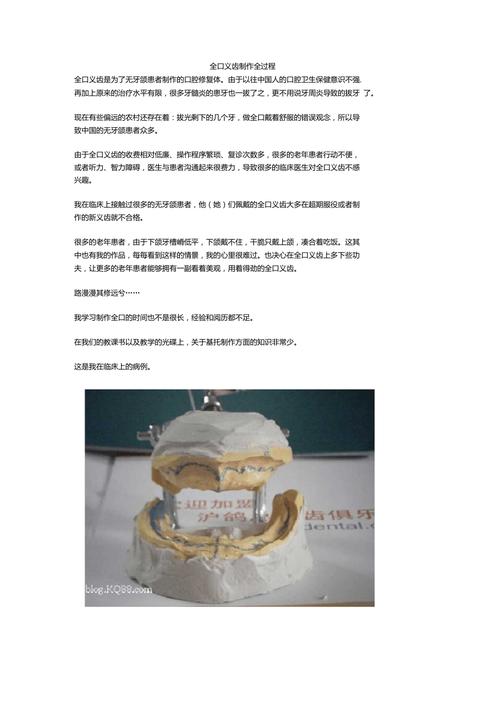 假牙工艺流程订制私人新发明(义齿假牙工艺流程牙科口腔)