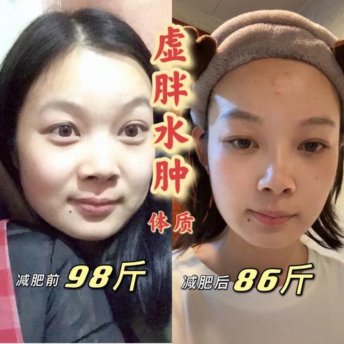 气色水肿脸部动作精神收藏(水肿脸部气色下颚锁骨)