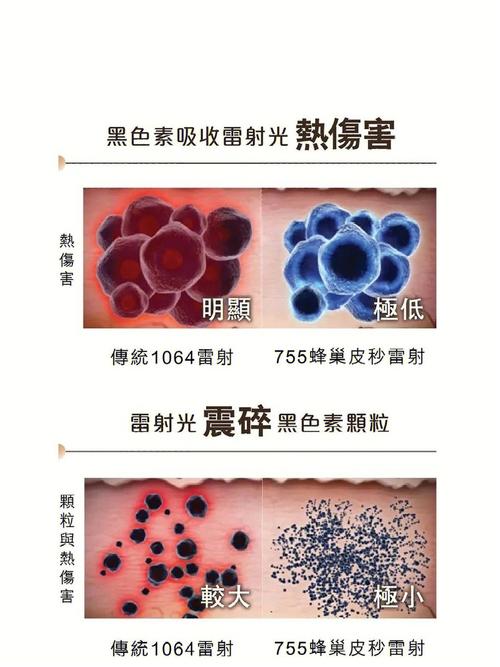 蜂巢三大皮肤Picosure(蜂巢三大皮肤自己的广东省)