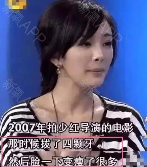 来了高科技瘦脸意外(小朱西湖杭州市来了记者)
