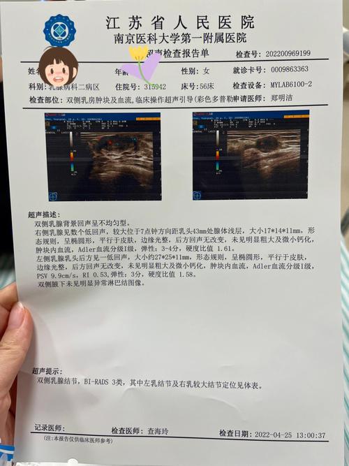 手术要多乳腺微创纤维瘤费用(手术乳腺纤维瘤花了微创)