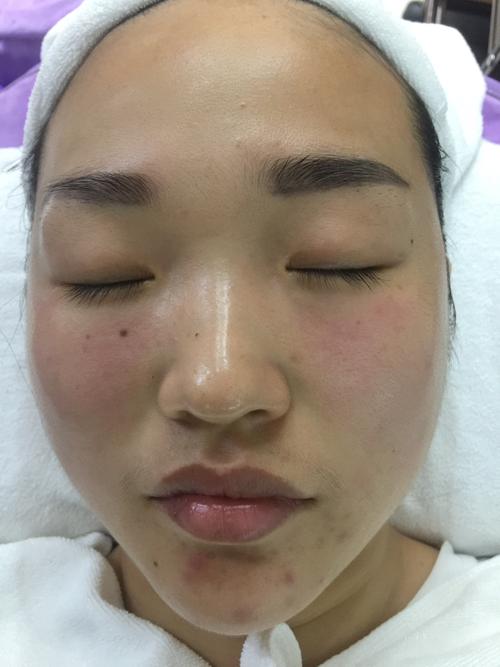 你知道这样做肌肤混合性脸上鸡蛋(混合性皮肤你知道这样做脸上)