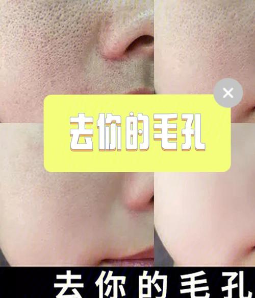 粗大毛孔小技巧男士(毛孔粗大男士小技巧技巧)