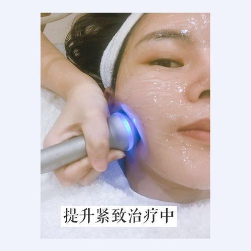 射频皮肤护理项目(射频模式皮肤护理项目我会)