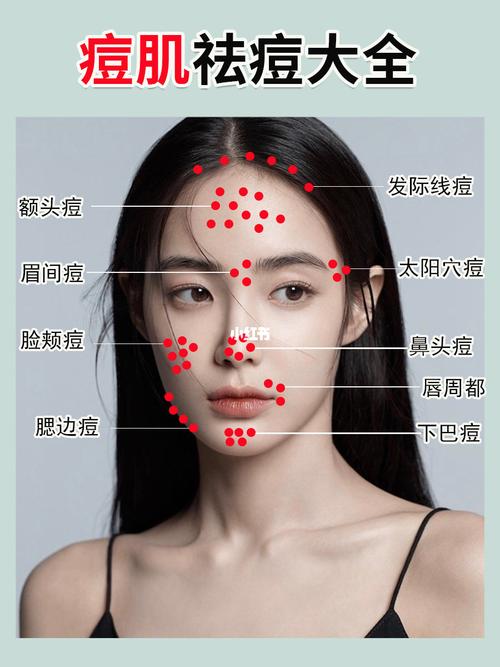 毛孔祛痘方法(毛孔痘痘暗疮面部颜面)