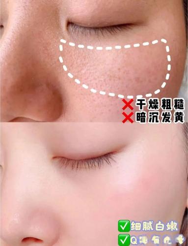 透亮残余光洁变身脸上垃圾(透亮残余光洁变身脸上)