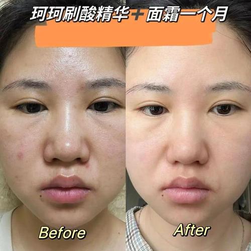 不全美容院智商项目(美容院低价项目精油不全)