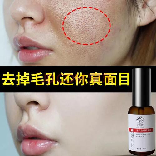细毛毛孔瑕疵爽肤水干净精华(毛孔细毛精华爽肤水瑕疵)