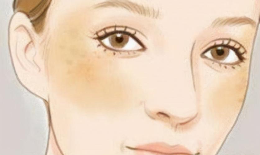 更显克星排毒去斑黄脸婆年轻(排毒更显克星年轻黄脸婆)