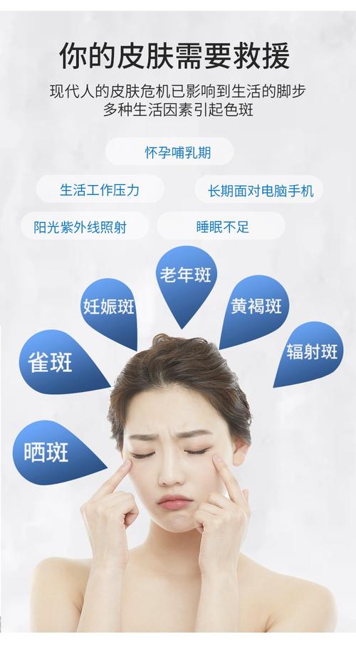 老年斑妙招一键脸上(老年斑在线妙招脸上家庭医生)
