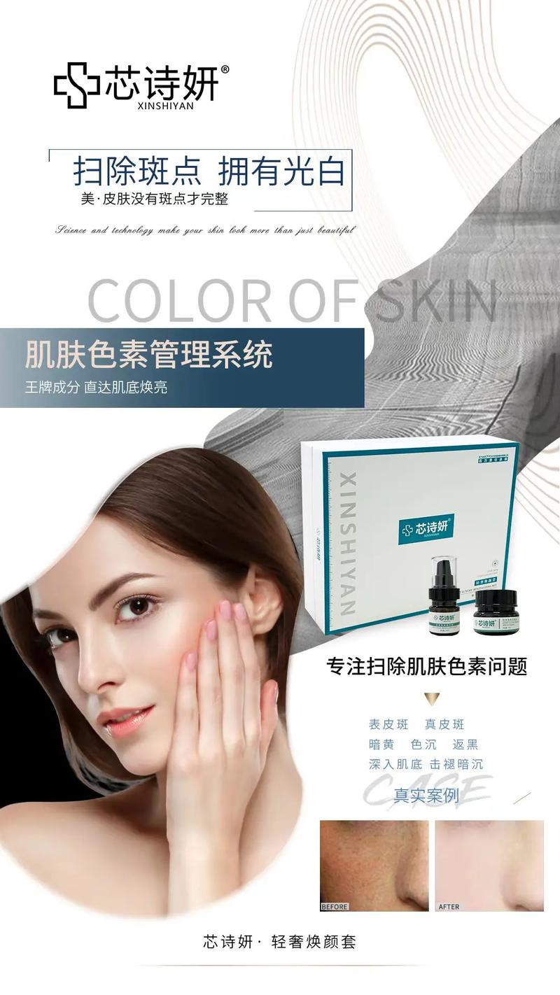 组合美白王牌秋冬(美白肌肤组合成分王牌)