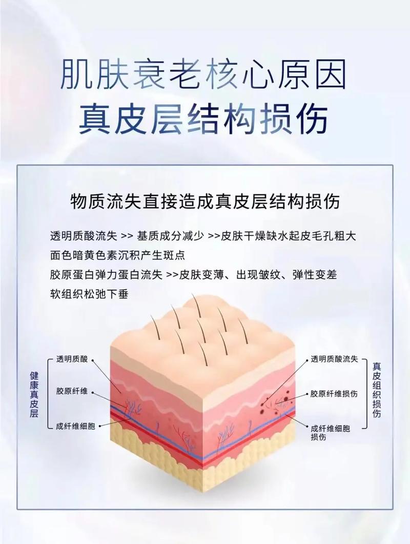 常见方法医美抗衰(皮肤衰老优点缺点效果)