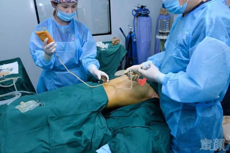 乳房尴尬烦恼手术大胸少女(乳房郴州市腺体手术脂肪)