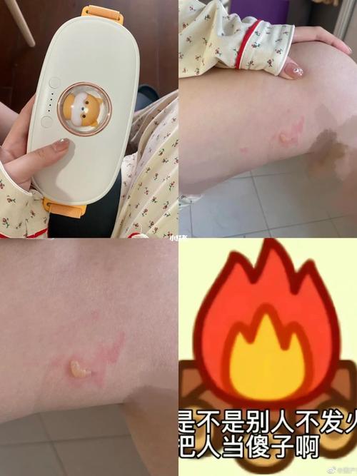 奶奶肚子做暖宫(奶奶烫伤伤口血糖糖尿病人)