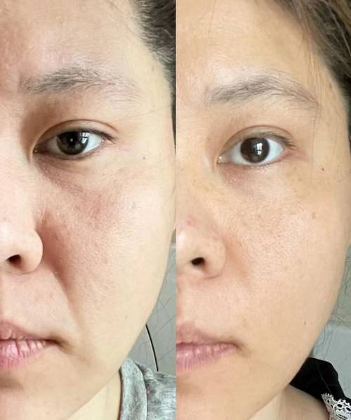 之王美白衰老女人(气血美白女人之王衰老)