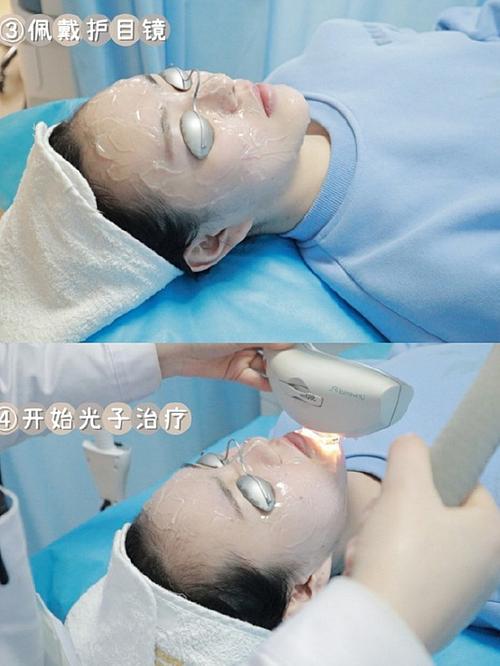你要嫩肤光子真相医美小白可(嫩肤光子皮肤武汉操作)
