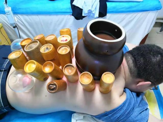 清代面部火了滚轮拔罐(面部滚轮拔罐清代火了)