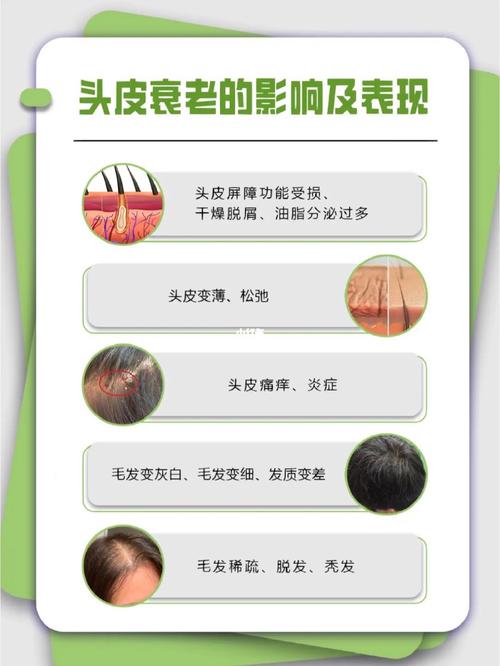 头皮更重要努力项目系统(头皮项目陆海空系统更重要)