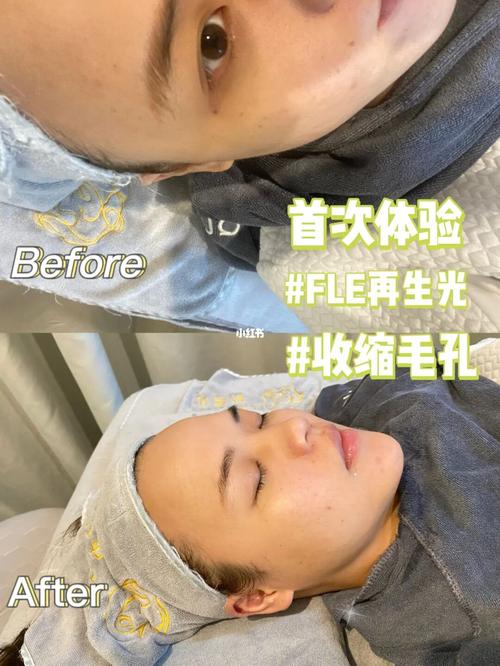 花了多少钱在脸上(花了多少钱皮肤在脸上线粒体)