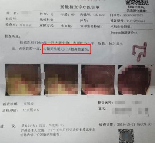 一颗算不算(病理手术省城一颗朝乾夕惕)