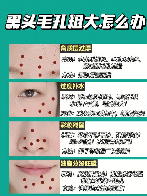 黑头分析报告深度人气(黑头提取物成分乙酸羟基)
