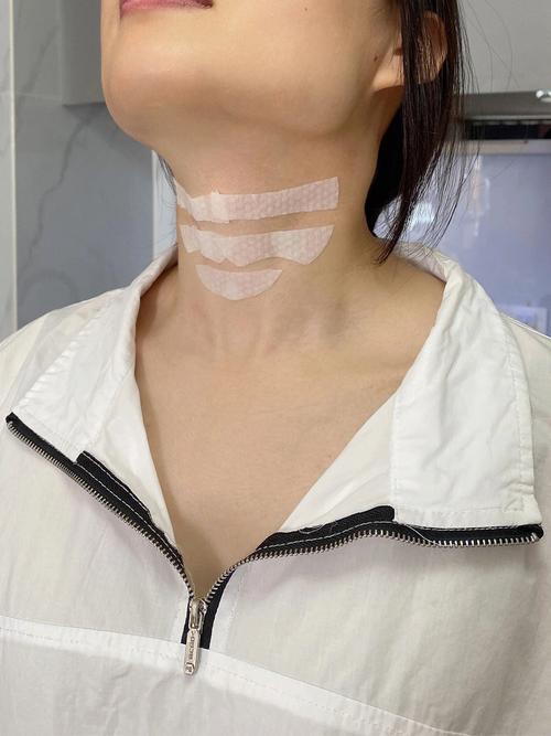 这一救了打完颈纹有(这一救了打完透明质酸交联)