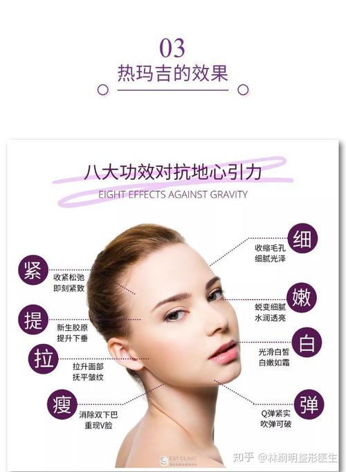 最强玩家市场版热玛吉(市场射频美容院效果能量)