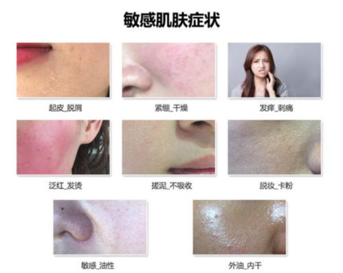 肌肤也能敏感日常(肌肤敏感皮肤在线敏感性)