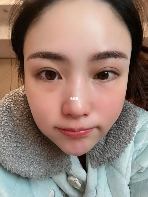 搞了十个月星范(十个月女士搞了眼袋宁波)