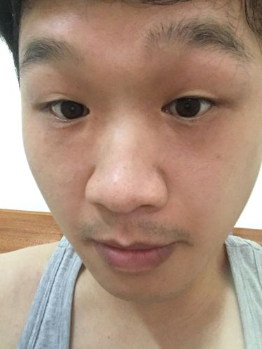 最受关注男性项目(主任眼袋男性黑眼圈项目)