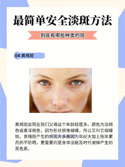 那么多祛斑方法最靠谱(黑色素祛斑色斑活性齐鲁)