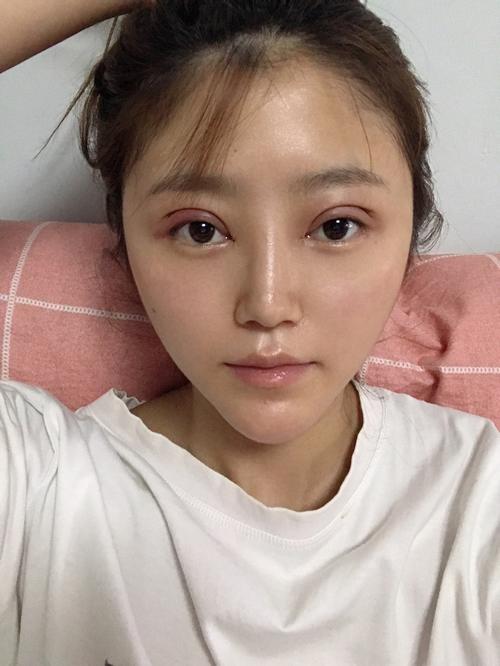 暑假内变美美大招(原价双眼皮郑州市暑假色料)