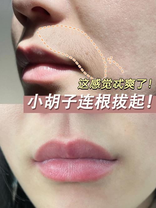小胡子快来不做汉子激光尴尬(小胡子激光快来不做汉子)