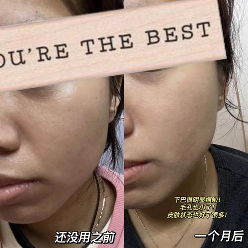 几个优缺点面部常见项目扒一扒(几个优缺点面部项目常见)