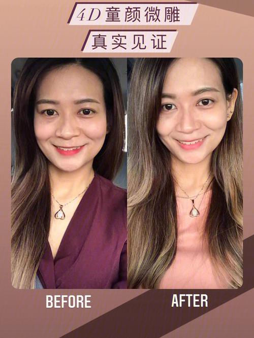 一脸是从点到微整(自己的一脸文秀是从点到)
