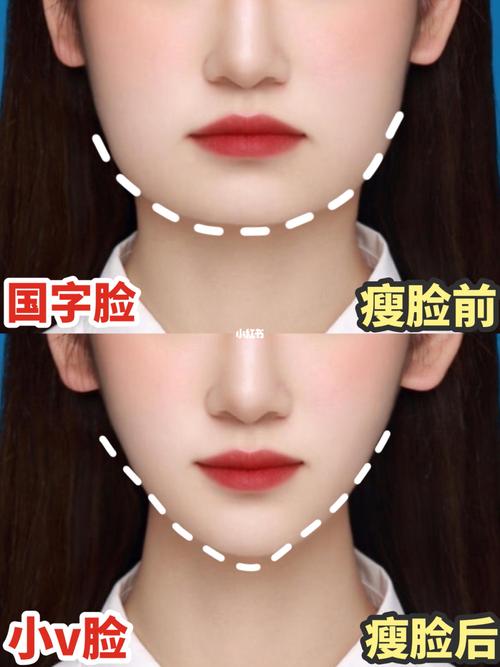 还能日本头痛瘦脸步骤(日本还能头痛肌肉瘦脸)