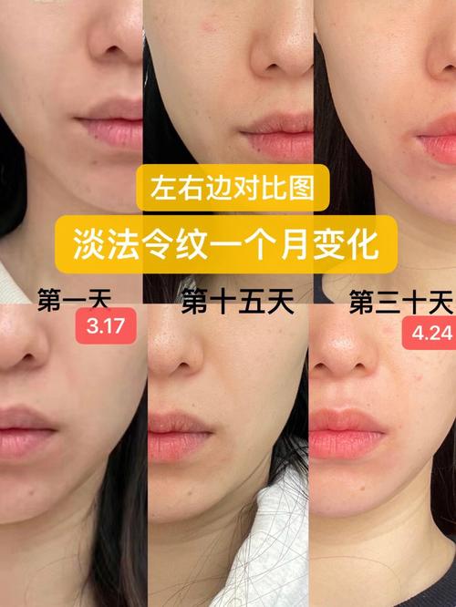 小脸面部不对称(面部如果你不对称这是瑜伽)