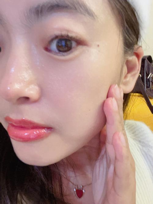 美颜张脸暑假相机微整(医生美颜正规面部项目)