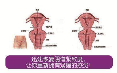 私密帮你(私密部位女性衰老帮你)