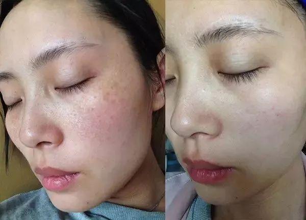 痕迹岁月养生保健(皮肤活力身体自若肌肤)