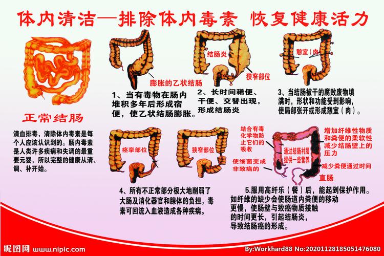 莫要随便清肠(清肠肠道排毒肠胃方法)