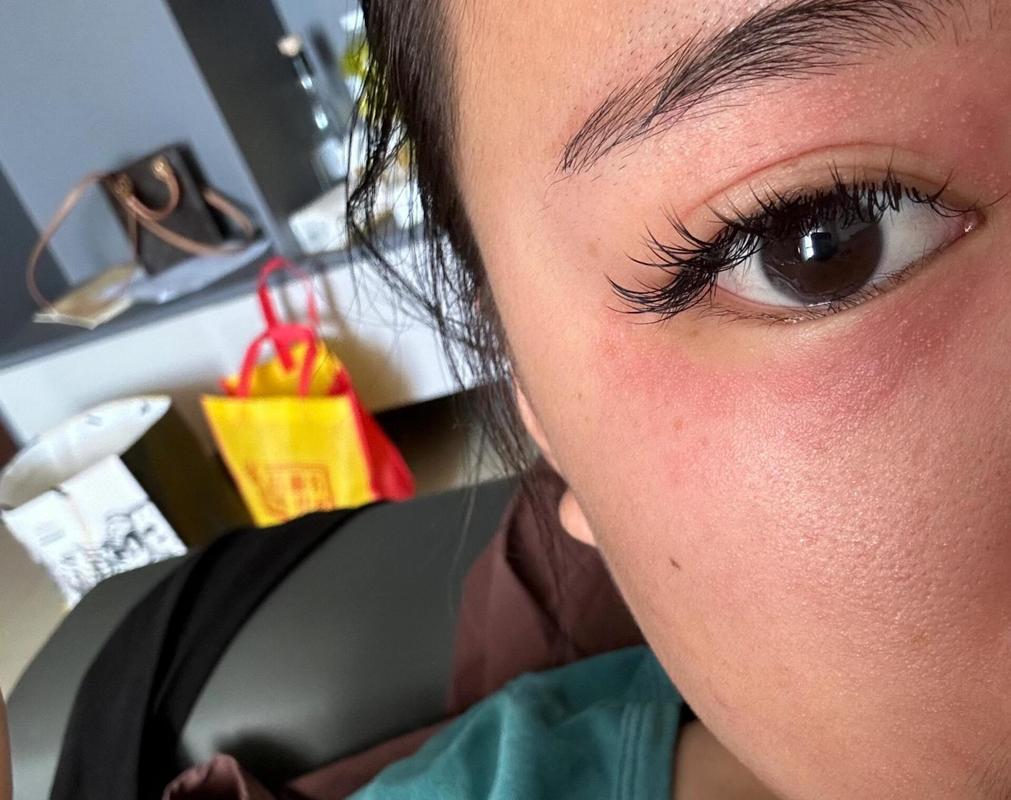 童颜翻车猪头瘦脸美女主播脸肿(童颜翻车猪头自己的瘦脸)