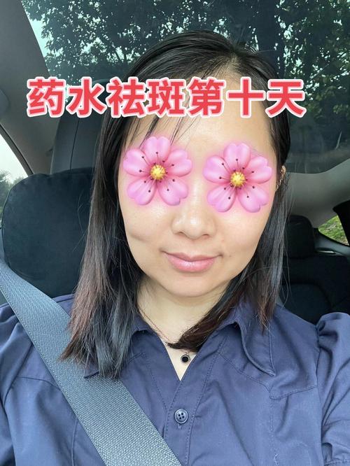 黑心套路美容院肮脏手段(对我业务员祛斑让我美容院)