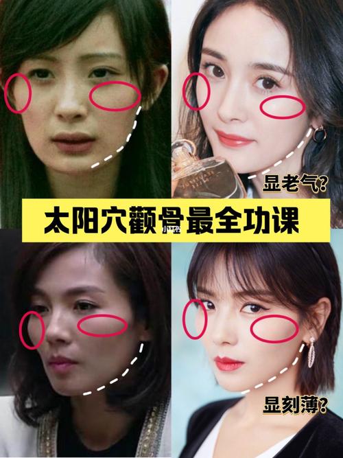 颧骨太阳穴妙招(颧骨太阳穴歪斜下颌面部)