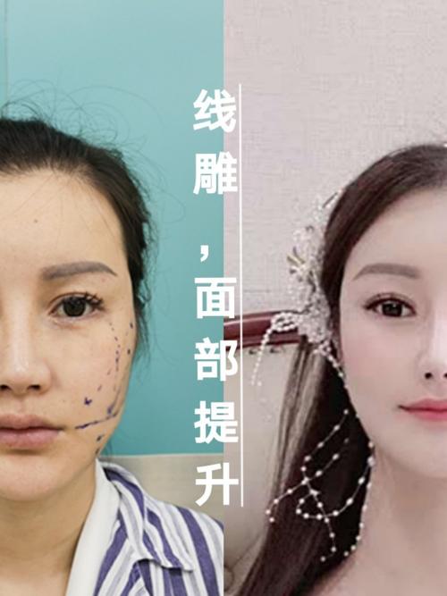 美容师御用别怕造型线了度靠脸(美容师御用别怕造型线了)