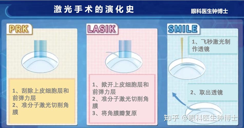 近视眼如何选择手术系列有哪些沈烨(角膜手术术后近视近视眼)